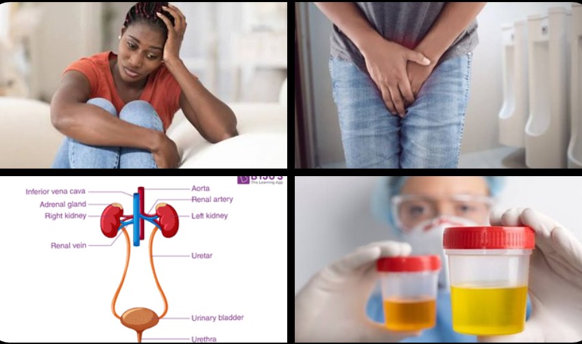 An Abnormal Coloured Urine May Be Considered Dangerous If Not Quickly Attended To.. Here Are Some Things To Know